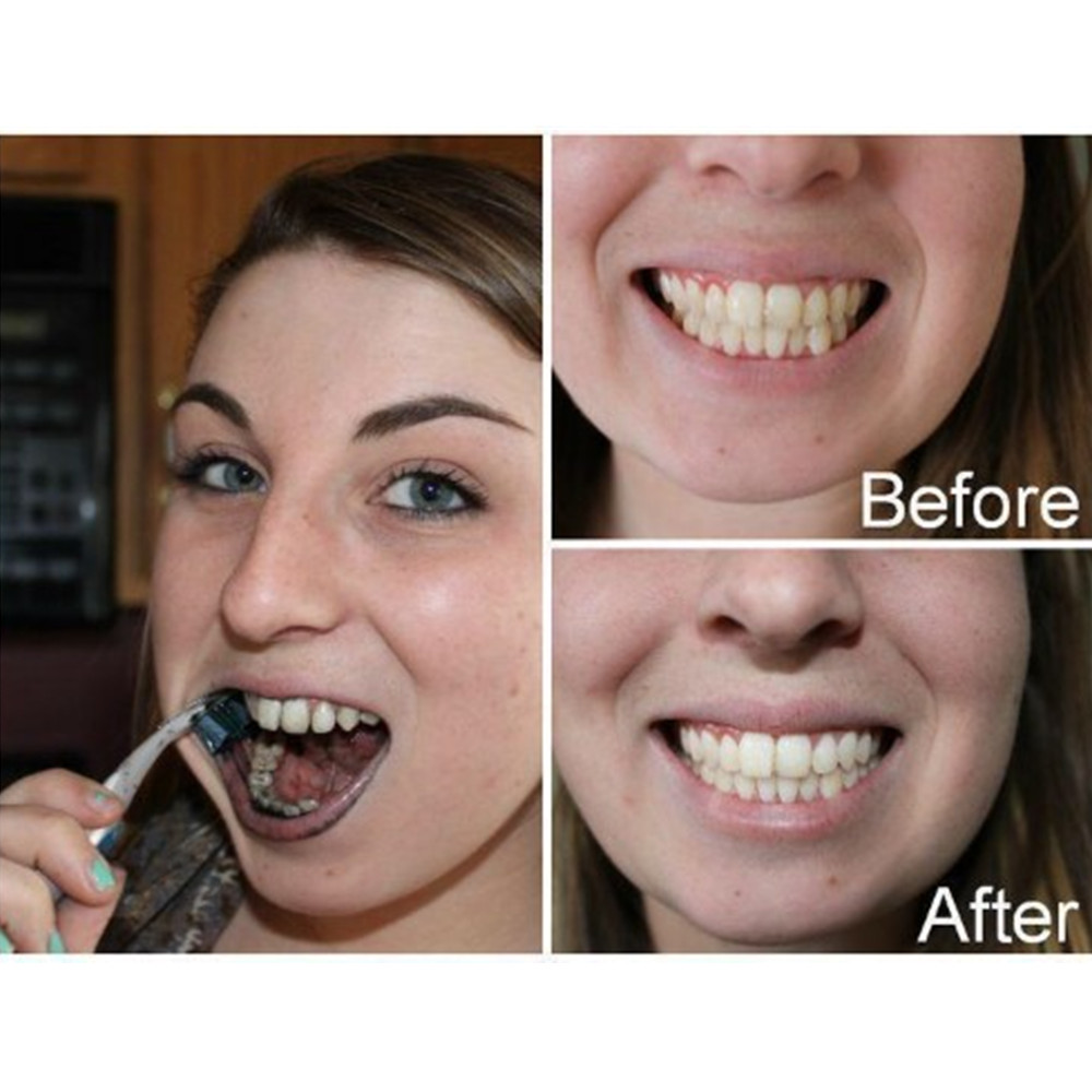 Bambu kömür diş diş diş hekimi - Teeth Whitening Ulta incelemesi ve fiyatı