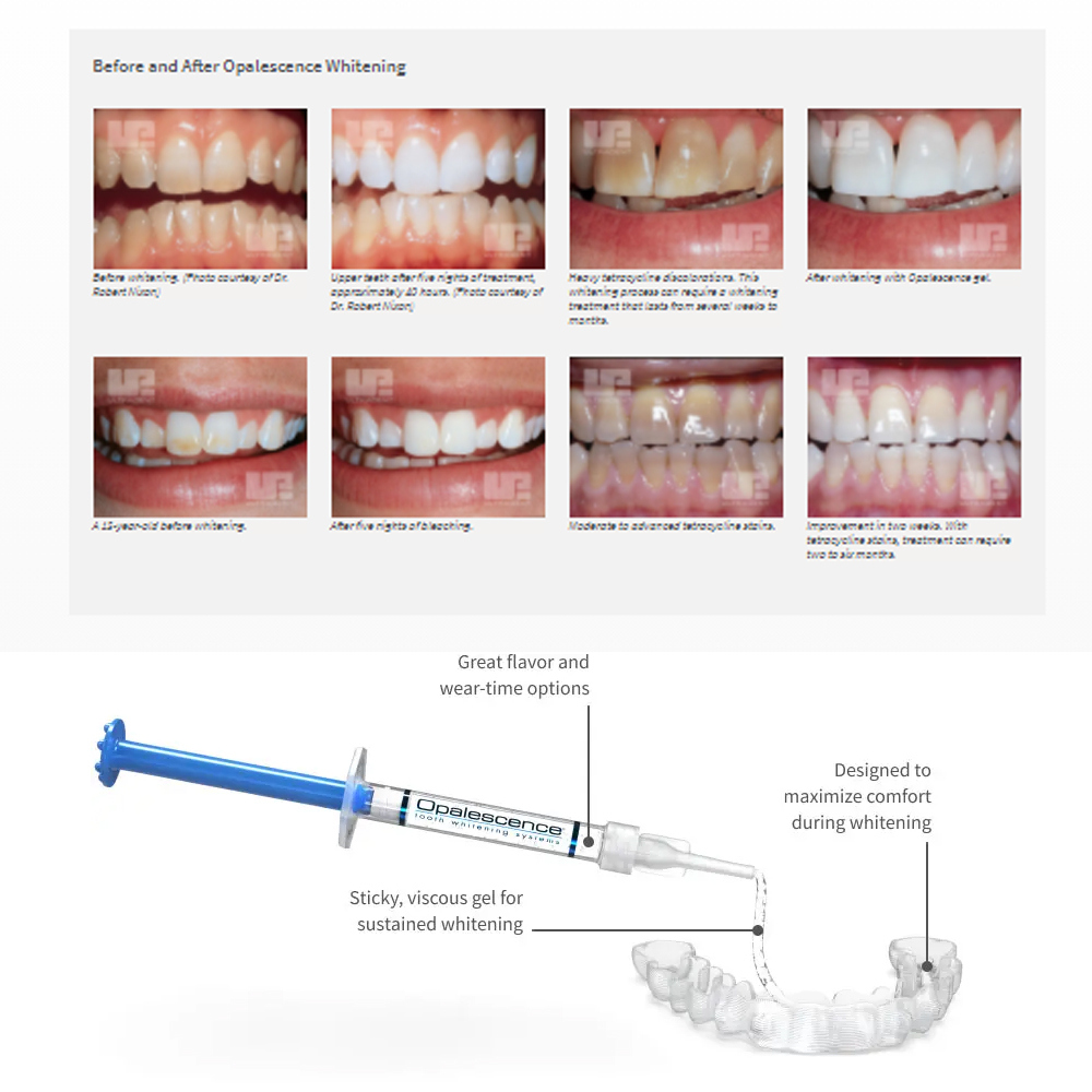 Opalescence beyazlatma 20% PF  - Teeth Whitening Ulta incelemesi ve fiyatı